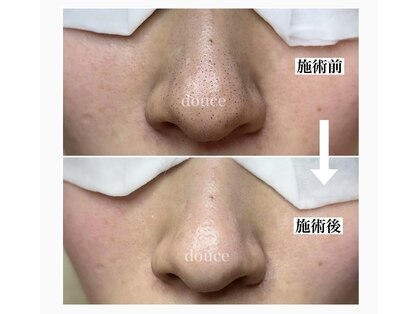 ドゥース(douce)の写真