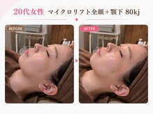 リフト 西船橋(Lift)/【西船橋】小顔・痩身専門店Lift
