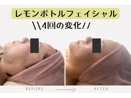 メディカルエステサロン ローズ 金沢本店(ROSE)の写真