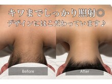 サラ 恵比寿店(SARA)の雰囲気（濃い毛～産毛までしっかり効果◎ワンランク上の脱毛を体感）