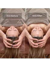 スリージー/before／after