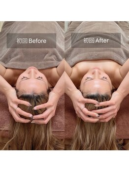 スリージー/before/after