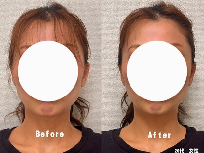 コガオプラス(KOGAO Plus+)の写真