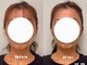 コガオプラス(KOGAO Plus+)の写真
