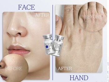 サロン ド アリーナ(Salon de Alina)/