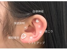 アマンズアイ(amans eye)/耳つぼジュエリー10個コース