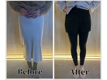 整体ラルース 中目黒(LALUZ)/30代　女性　産後骨盤矯正　変化