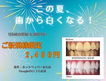 ホワイトニングショップ 名古屋店