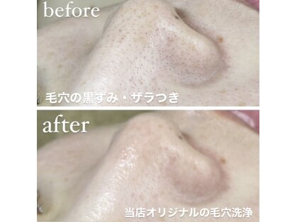 オルネ(ORNE.)の写真
