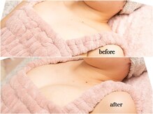 ルーナ(Luna)の雰囲気(バストアップメニュー9月からスタートしました!)