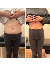 ナオ接骨院(NAO接骨院)/Before／After