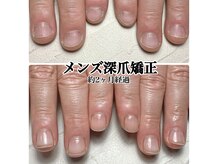 スマイルニコ(smile nico)の雰囲気（男性の深爪相談増えています！清潔感ある手元は好感度アップ）
