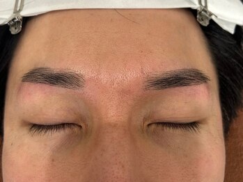 スリーズララ(Cerise LaLa)/お客様症例/眉毛WAX