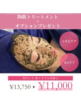 ディオーネ 泉佐野店(Dione)/ハーブピーリングで根本解決♪