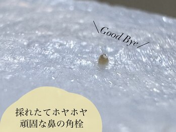 ムゥ(Mwoo)/フェイシャルワックス/顔脱毛