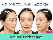 ナチュラルパーフェクトフェイス 新宿