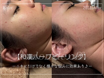 サロンドオフ 西梅田(salon de off)の写真