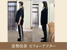 オリエンタル整体院 新潟院/20代 サービス業 姿勢改善成果