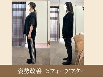 オリエンタル整体院 新潟院/20代 サービス業 姿勢改善成果