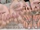 シュシュ(chouchou)の写真