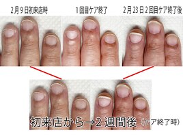 自爪育成/地爪育成/美爪育成
