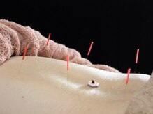 プラステン治療院 / コットンタイム/お身体の不調はお任せください。