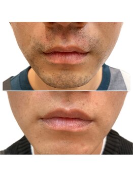 エピシアドットエヌ(epicia.N)/新たな印象を