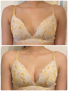 ハク 阪急茨木(HAKU)/お客様の変化*バストケア