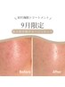 9月限定★秋の贅沢美肌スペシャルset【ハイドラ×REVIハーブ】¥18780→¥15000