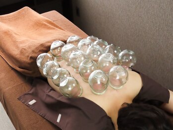 康泰苑鍼灸整体院/大塚駅/22時まで営業/カッピング