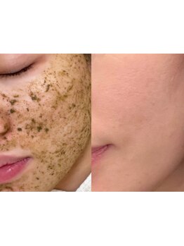 お肌をきれいにしたい