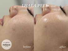 ナルカ(naluca)/【堺市・深井】ララピール