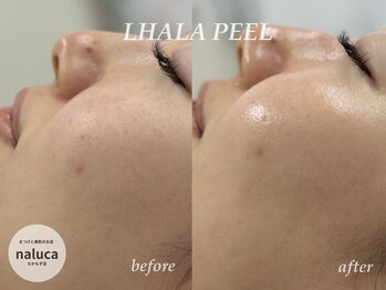 ナルカ(naluca)/【堺市・深井】ララピール