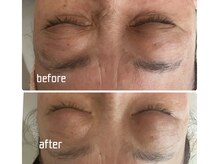 オッペンプラザ アルーリング(oppen plaza Alluring)の雰囲気(雪によるストレス顔も、表情がゆるみ第一印象を明るく)