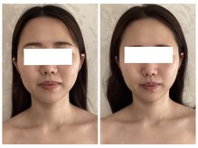 リコ(Rico)の雰囲気（1回で驚きの変化！熟練のRico式造顔で理想のフェイスラインへ）