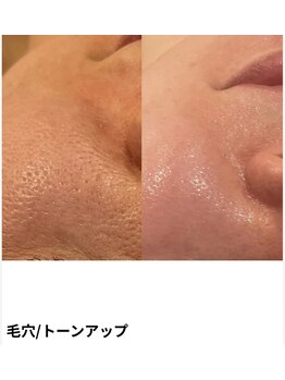 ミラビューティー(Mira Beauty)/毛穴の開き改善/トーンアップ