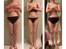 エステティック リオン(Rion)/ビフォーアフター