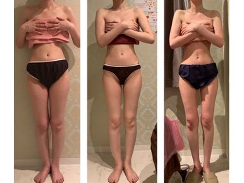 エステティック リオン(Rion)/ビフォーアフター