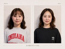 ハリスタ(HARISTA)/美容鍼＋小顔矯正＋LED美容
