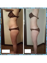 プライベートサロン 美月/全身キレイ痩せ！美ボディへ