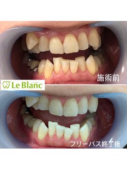 ルブラン 奈良店(Le Blanc)/リーズナブルなお値段で！