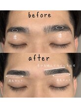 ヒース(Heath)/before＆after