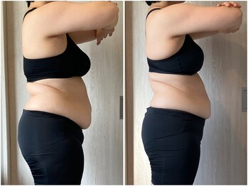 インプルーブ 浜北店(Improve)/お腹周り-10ｃｍ！　30代女性
