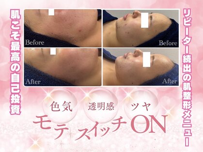 アイリス(airis)の写真