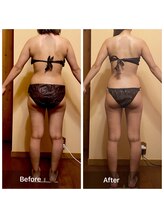 プライベートサロン アール(R)/セルゼロボディ（全身90分）