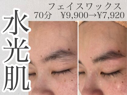 エースマイルイズ(A smile is..)の写真