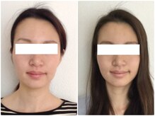 美容整体ウェリナ あま甚目寺院/小顔矯正/骨盤矯正/美脚サロン