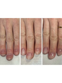 爪の悩みを解消できる（ケア含む）