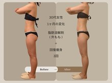 ソル 札幌平岸(Sol)の雰囲気（札幌/平岸/脂肪分解/回復エステ/代謝改善/肩こり/ダイエット）