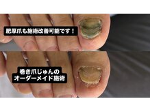巻き爪じゅん 千葉駅前店の雰囲気（巻き爪専門15年！どんな爪でもご相談ください！）